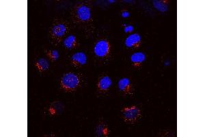 Immunocytochemistry/Immunofluorescence analysis using Mouse Anti-KDEL Receptor Monoclonal Antibody, Clone KR-10 (ABIN361675 and ABIN361676).