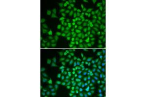 Immunofluorescence analysis of HeLa cells using COPS5 antibody.