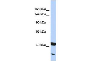 Host:  Rabbit  Target Name:  NFKB2  Sample Type:  Jurkat Whole cell lysates  Antibody Dilution:  1. (NFKB2 Antikörper  (N-Term))