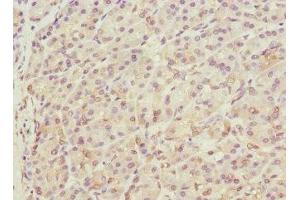 Immunohistochemistry of paraffin-embedded human pancreatic tissue using ABIN7172143 at dilution of 1:100 (THADA Antikörper  (AA 1684-1953))