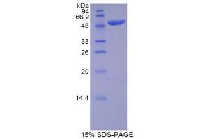 SDS-PAGE (SDS) image for Apolipoprotein B (APOB) (AA 331-511) protein (His tag,GST tag) (ABIN1877788)