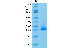 Human FGF10 on Tris-Bis PAGE under reduced condition. (FGF10 Protein)