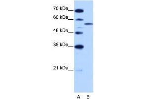 Human HepG2; WB Suggested Anti-ZRSR2 Antibody Titration: 2. (ZRSR2 Antikörper  (C-Term))