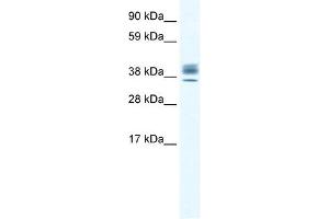 ESX1 antibody (20R-1122) used at 0. (ESX Homeobox 1 Antikörper  (N-Term))