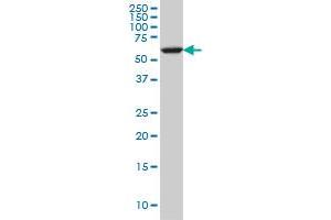 FAAH monoclonal antibody (M07), clone 4H8 Western Blot analysis of FAAH expression in A-431 .
