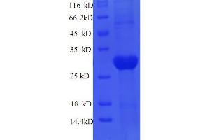 SDS-PAGE (SDS) image for Janus Kinase 3 (JAK3) (AA 818-110) protein (His tag) (ABIN5711395) (JAK3 Protein (AA 818-110) (His tag))