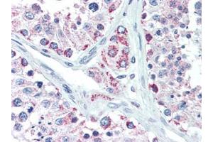 Human Testis (formalin-fixed, paraffin-embedded) stained with LIN28Bfollowed by biotinylated goat anti-rabbit IgG secondary antibody, alkaline phosphatase-streptavidin and chromogen. (LIN28B Antikörper  (N-Term))
