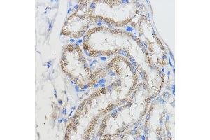 Immunohistochemistry of paraffin-embedded Mouse kidney using CYP51 Rabbit pAb (3485) at dilution of 1:50 (40x lens). (CYP51A1 Antikörper  (AA 210-509))