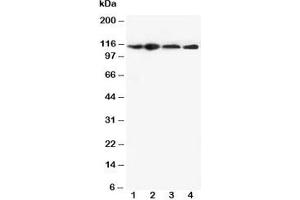 Western blot testing of NLRP3 antibody and Lane 1:  HEP-2;  2: A549;  3: U87;  4: CEM cell lysate