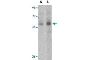 Western blot analysis of SCARB1 in human spleen tissue lysate with SCARB1 polyclonal antibody  at (A) 1 and (B) 2 ug/mL . (SCARB1 Antikörper  (N-Term))