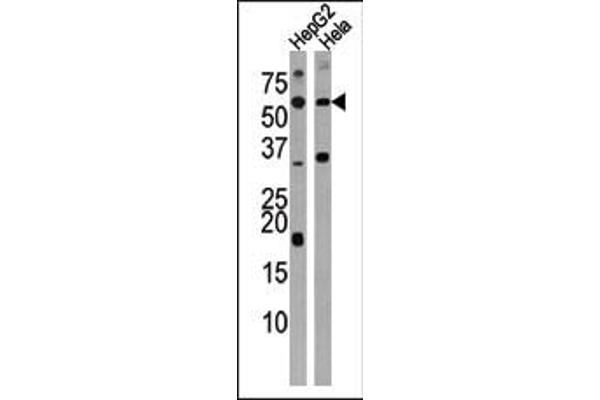 ACVR1C/ALK7 Antikörper  (N-Term)