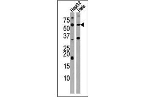 ACVR1C/ALK7 Antikörper  (N-Term)