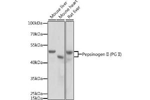 Western blot analysis of extracts of various cell lines, using Pepsinogen II (PG II) antibody (ABIN3016694, ABIN3016695, ABIN3016696 and ABIN6219816) at 1:1000 dilution. (PGC Antikörper  (AA 100-200))