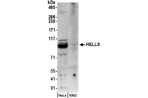 anti-Helicase, Lymphoid-Specific (HELLS) (AA 550-600) antibody