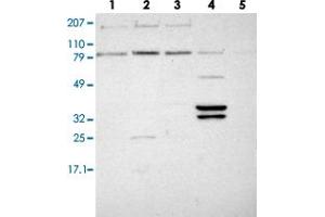 Western blot analysis of lane 1: RT-4, lane 2: EFO-21, lane 3: A-431, lane 4: Liver and lane 5: Tonsi lusing PLEK2 polyclonal antibody . (Pleckstrin 2 Antikörper)