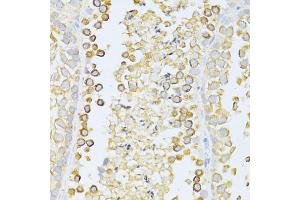 Immunohistochemistry of paraffin-embedded mouse testis using MAP1LC3B antibody (ABIN6291773) at dilution of 1:100 (40x lens). (LC3B Antikörper)
