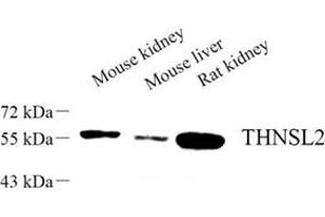 Western blot analysis of THNSL2 (ABIN7075893) at dilution of 1: 500 (THNSL2 Antikörper)