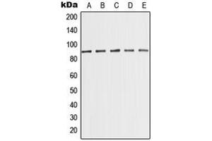 Western blot analysis of MED15 expression in MCF7 (A), K562 (B), HeLa (C), NIH3T3 (D), PC12 (E) whole cell lysates. (MED15 Antikörper  (Center))