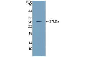 Western blot analysis of recombinant Human IGSF16. (CD300c Antikörper  (AA 21-183))