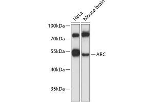Western blot analysis of extracts of various cell lines, using ARC antibody (ABIN6131195, ABIN6137063, ABIN6137064 and ABIN6224919) at 1:3000 dilution. (ARC (AA 1-220) Antikörper)