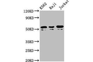 Western Blot Positive WB detected in: K562 whole cell lysate, Raji whole cell lysate, Jurkat whole cell lysate All lanes: TOX2 antibody at 4. (TOX2 Antikörper  (AA 303-417))