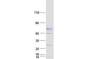 Western Blotting (WB) image for V-Set and Immunoglobulin Domain-Containing Protein 4 (VSIG4) (Transcript Variant 1) protein (Myc-DYKDDDDK Tag) (ABIN2735446)
