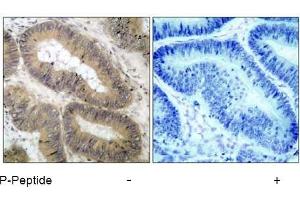 Image no. 1 for anti-conserved Helix-Loop-Helix Ubiquitous Kinase (CHUK) (pThr23) antibody (ABIN196837) (IKK alpha Antikörper  (pThr23))