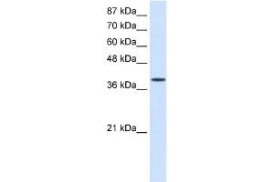 WB Suggested Anti-EIF4G2 Antibody Titration:  0.