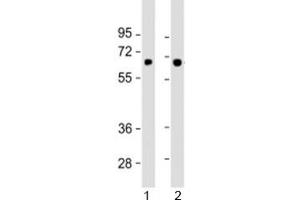 Western blot testing of human 1) SK-BR-3 and 2) TT cell lysate with SLC5A8 antibody at 1:1000.