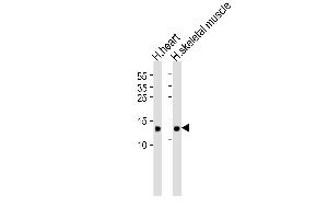 Western blot analysis of lysates from human heart and skeletal muscle tissue lysate(from left to right), using FABP3 Antibody (ABIN6242886 and ABIN6577405). (FABP3 Antikörper  (AA 1-133))
