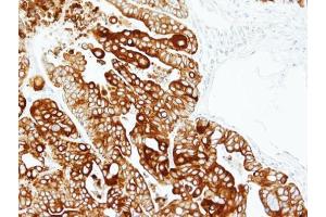 Immunohistochemistry (IHC) image for anti-Keratin 17 (KRT17) antibody (ABIN2855697)