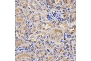 Immunohistochemistry of paraffin-embedded mouse kidney using CFB antibody at dilution of 1:200 (x400 lens) (Complement Factor B Antikörper  (AA 80-420))