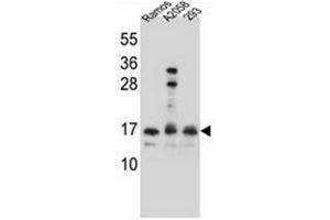 Western blot analysis of Homeodomain-only protein / HOP Antibody  in Ramos,A2058,293 cell line lysates (35ug/lane).