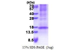 SDS-PAGE (SDS) image for Defensin, beta 116 (DEFB116) (AA 24-102) protein (His tag) (ABIN5778678) (DEFB116 Protein (AA 24-102) (His tag))