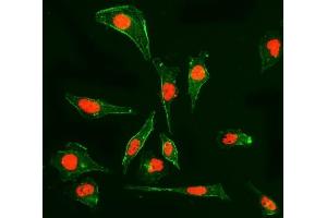 IF analysis of Cyclophilin E/PPIE using anti-Cyclophilin E/PPIE antibody (ABIN7599243). (PPIE Antikörper  (AA 1-301))