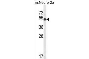 Western blot analysis of GPI Antibody (C-term) in mouse Neuro-2a cell lysates (35µg/lane).