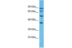 Western Blotting (WB) image for anti-Pseudouridylate Synthase 7 Homolog-Like (PUS7L) (N-Term) antibody (ABIN2791889) (PUS7L Antikörper  (N-Term))