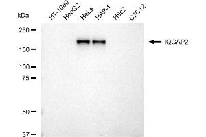 Western blotting analysis using IQGAP2 antibody (ABIN7799122). (Rekombinanter IQGAP2 Antikörper)