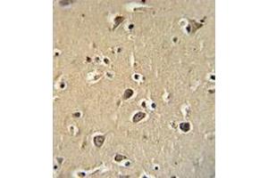 Immunohistochemistry (Paraffin-embedded Sections) (IHC (p)) image for anti-Protocadherin gamma Subfamily C, 3 (PCDHGC3) (AA 518-547), (Middle Region) antibody (ABIN954050)
