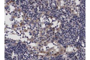ABIN6266689 at 1/100 staining human Lymph node tissue sections by IHC-P. (TP53I11 Antikörper  (N-Term))