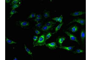 Immunofluorescent analysis of Hela cells using ABIN7173241 at dilution of 1:100 and Alexa Fluor 488-congugated AffiniPure Goat Anti-Rabbit IgG(H+L) (TMEM56 Antikörper  (AA 232-263))