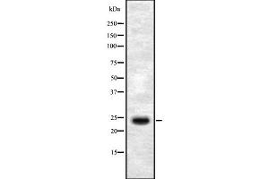 Western blot analysis SEI-1 using HepG2 whole cell lysates (SERTAD1 Antikörper  (Internal Region))