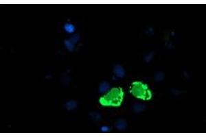 Anti-ENPEP mouse monoclonal antibody (ABIN2455323) immunofluorescent staining of COS7 cells transiently transfected by pCMV6-ENTRY ENPEP (RC210521). (ENPEP Antikörper)