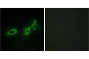 Immunofluorescence analysis of HeLa cells, using TRI18 Antibody. (MID1 Antikörper  (AA 71-120))