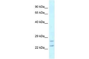 Western Blot showing RAB2A antibody used at a concentration of 1 ug/ml against MDA-MB-435S Cell Lysate (RAB2A Antikörper  (C-Term))