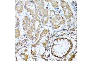 Immunohistochemistry of paraffin-embedded human stomach using NRG4 antibody. (Neuregulin 4 Antikörper)