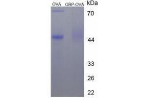 Image no. 3 for Gastrin-Releasing Peptide (GRP) peptide (Ovalbumin) (ABIN5666189) (Gastrin-Releasing Peptide (GRP) peptide (Ovalbumin))