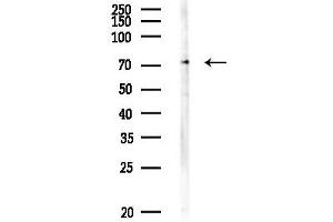 anti-Sphingomyelin Phosphodiesterase 3 (SMPD3) antibody
