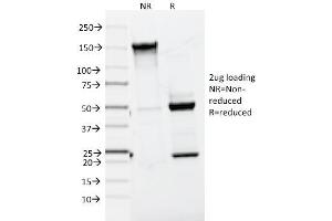 SDS-PAGE Analysis Purified MART-1 / Melan-A Mouse Monoclonal Antibody (A103). (MLANA Antikörper)