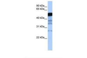 Image no. 1 for anti-E3 ubiquitin-protein ligase RAD18 (RAD18) (AA 197-246) antibody (ABIN6738067)